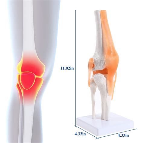 Knee Joint Model With Flexible Ligaments (Life Size) For Anatomical ...