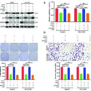 FBXO43 Promotes Cell Proliferation And Invasion Via UBE2C P53 Axis In