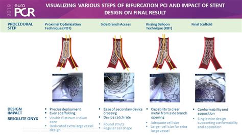 Left Main Bifurcation Stenting A Case Based Approach