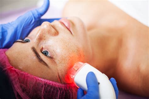 Effective Laser Therapy For Treating Acne Scars Your Ultimate Solution