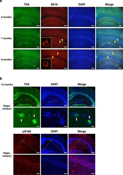 Age Dependent A Plaque Deposition And Hyperphosphorylated Tau In The