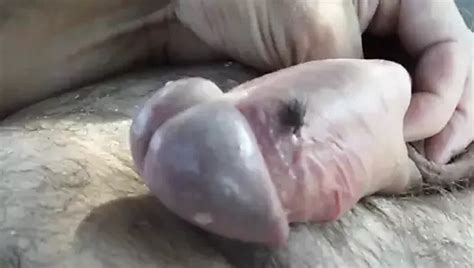 Foreskin Stretching Manual Daily Routine Part Gay XHamster