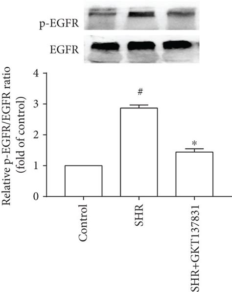 Nox Inhibitor Gkt Reduced Reactive Oxygen Species Ros