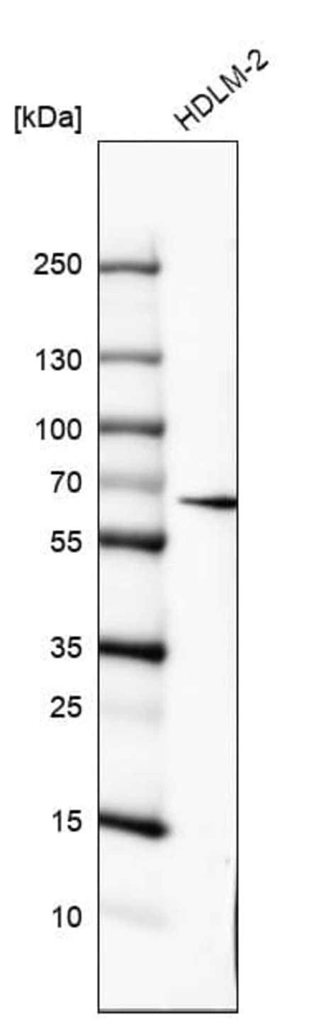 IL 10R alpha Antibody CL8203 Novus Biologicals 25 μg Unconjugated