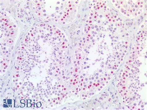 PathPlus™ EP300 / p300 Monoclonal Antibody Mouse anti-Human | LSBio
