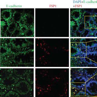 Inhibition of TL1A in intestinal epithelial cells in vitro using ... 