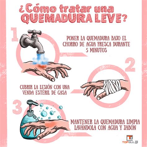 Como Debemos Actuar En Caso De Sufrir Una Quemadura Infografia Top Aul