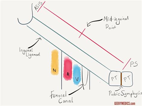 Hernias Inguinal Femoral Umbilical Geeky Medics