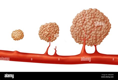 Angiogenesis hi-res stock photography and images - Alamy