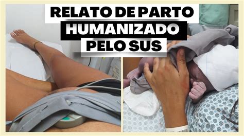 Meu Relato De Parto Normal Humanizado Pelo Sus Semanas