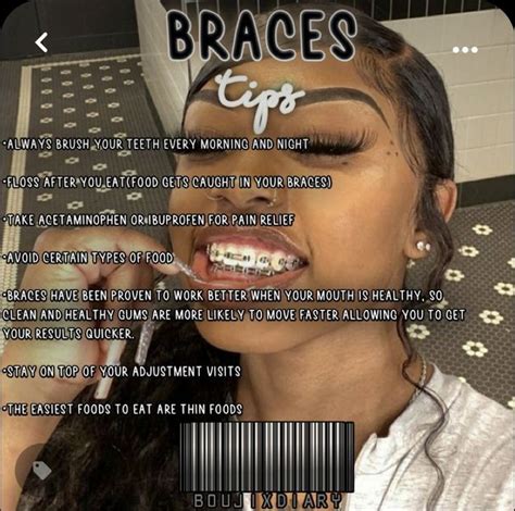 𝐏𝐫𝐢𝐧𝐧𝐲 𝐚𝐬𝐡🦋 Braces Tips Braces Teeth Colors Cute Braces