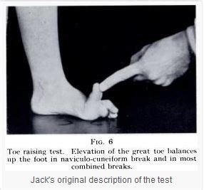 hubscher maneuver podiatry abc podiatry abc