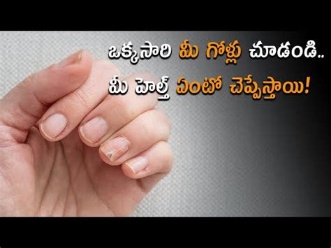 Nail Signs That Reveal Hidden Health Issues: What You Need to Know