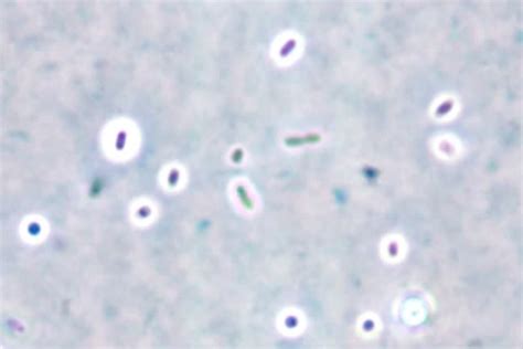 Capsule Stain: Principle, Procedure, Results – Microbe Online