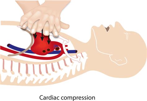 The Mechanism Of Blood Flow During Chest Compressions For Cardiac