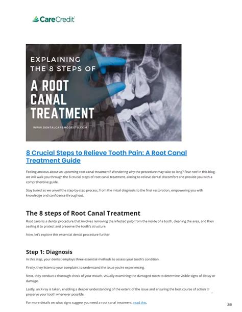 PPT - Root canal treatment guide PowerPoint Presentation, free download ...