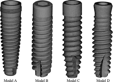 3D FE mesh model of commercial implant system. Model A, Nobel implant ...