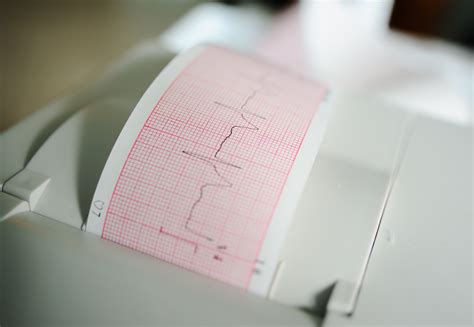 EKG am Handgelenk Bestimmte Herzrhythmusstörungen einfach mittels App