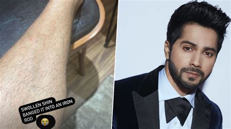 Varun Dhawan Injures Leg During Filming Next Project Provides Update