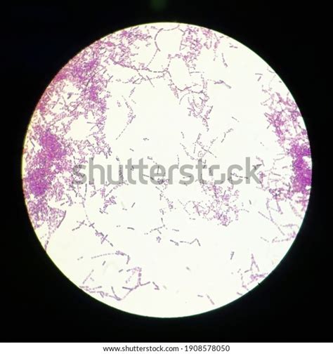 Bacillus Subtilis Gram Stain Under 40 Foto Stock 1908578050 Shutterstock