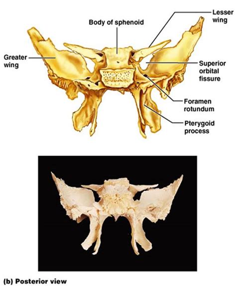 Boned Human Skull Pterygoid Process Of Sphenoid Bone