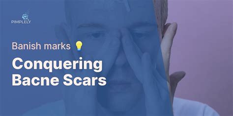 Understanding Back Acne Scars: Types, Prevention, and Treatment