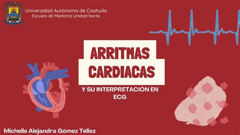 ARRITMIAS Y SU INTERPRETACIÓN EN ECG victoria valdivia uDocz