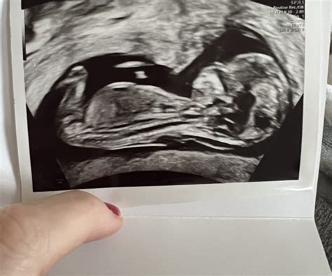 Just For Fun Anyone Want To Guess Sex Of My Baby Mumsnet