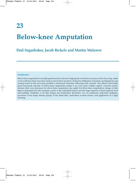 Below Knee Amputation Amputation Prosthesis