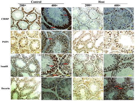 Immunohistochemical Staining Of CIRBP PSIP1 Sam68 And Decorin On