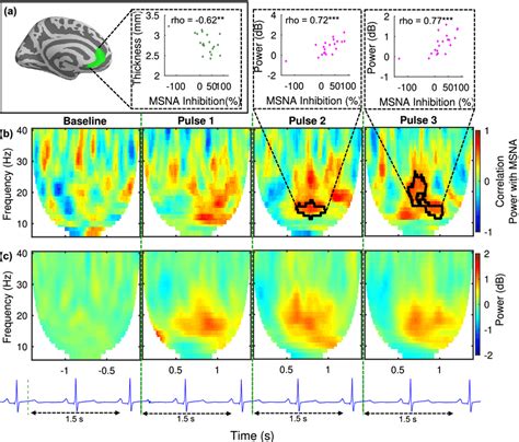 Structural And Functional Analysis Of The Anterior Cingulate Cortex