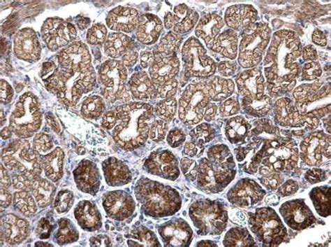 ITGB6 Antibody (PA5-35903)