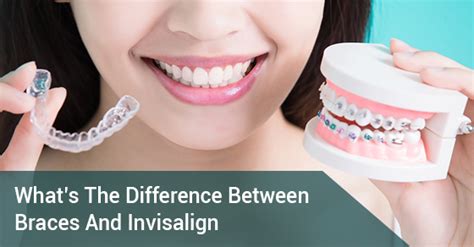 Whats The Difference Between Braces And Invisalign Willow Dental