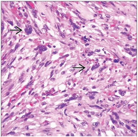 pecoma basicmedical key