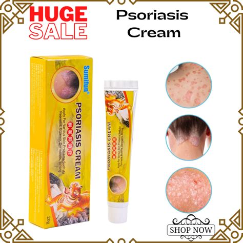 EFFECTIVE Psoriasis Eczema Treatment Cream Antibacterial 20g Quick Anti