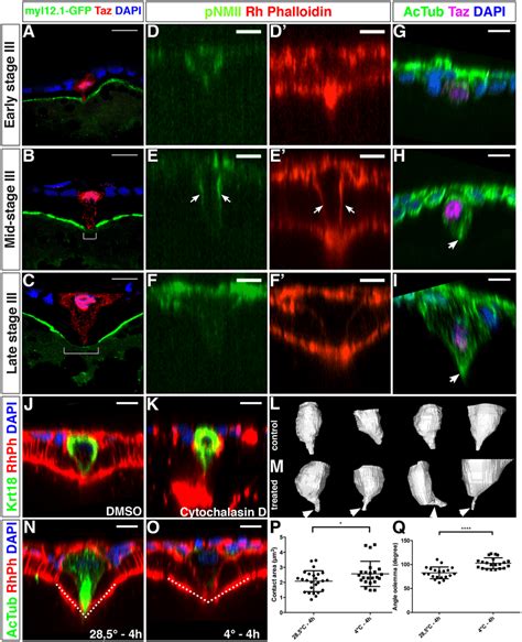 Actomyosin and microtubule cytoskeleton organization the MC. (A-C ...