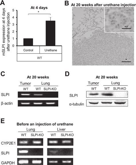 SLPI Expression And Urethane Metabolism In Mouse Lungs A