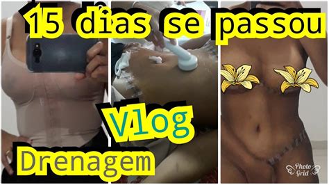 Abdominoplastia Mastopexia Pr Tese Dias De Operada Youtube