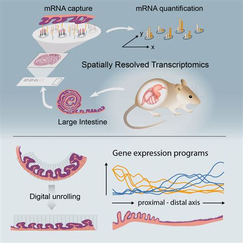 Colonic gene mapping gives insights into intestinal diseases