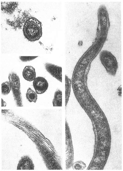 The Spirochetal Etiology Of Lyme Disease Nejm