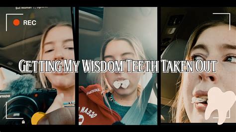 Getting My Wisdom Teeth Taken Out Chaotic Youtube