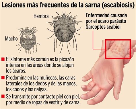 Sarcoptes Scabiei Sarna Humana