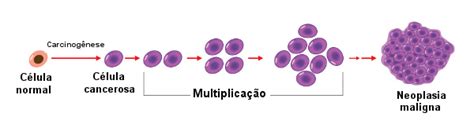 Neoplasia O Que Tipos Exemplos Tratamentos Brasil Escola