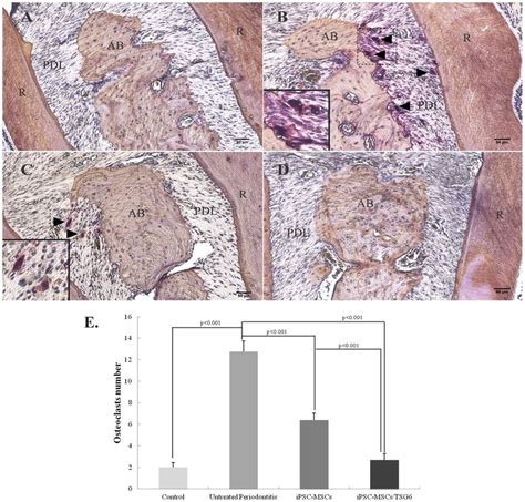 TRAP Staining Osteoclasts Formation In Different Groups A Healthy