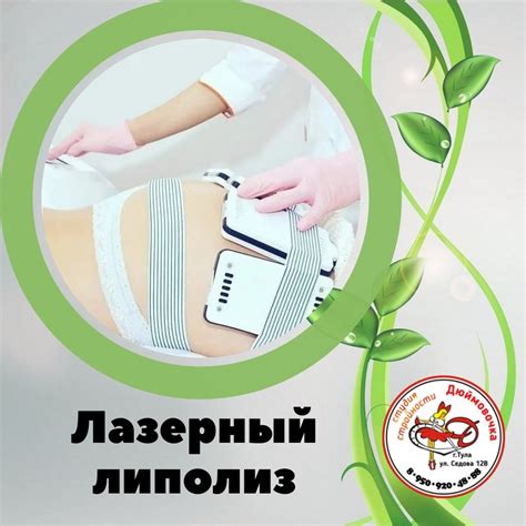 Лазерный липолиз | Тула