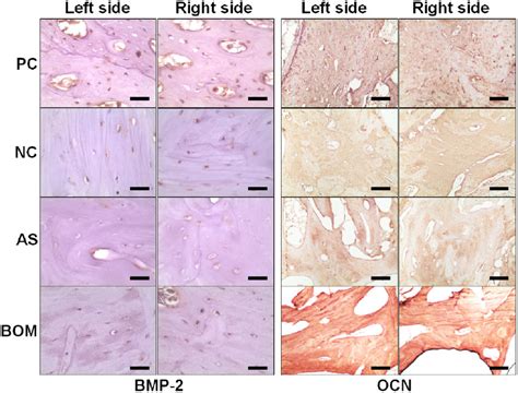 Histological Analysis Of BMP2 And Osteocalcin In The Palate Bone Of