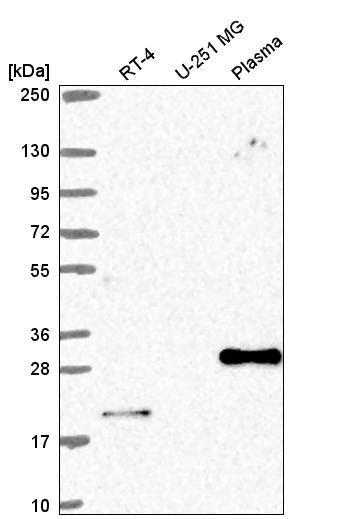 Rabbit Polyclonal Anti Cebpb Antibody Buy For Research Highly