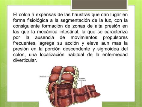 Enfermedad Diverticular De Colon Ppt Descarga Gratuita