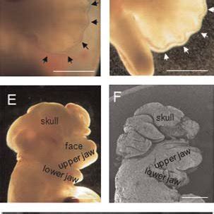 E13 Mouse And Hamster Embryos Lateral View Of Normal Mouse Embryo Of