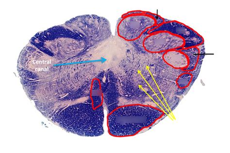 Caudal Closed Medulla Diagram Quizlet